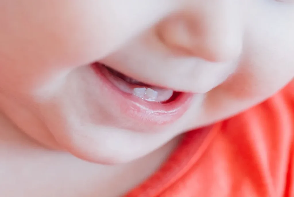 Alivio del dolor de dentición en bebés