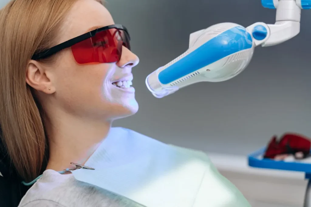 Blanqueamiento Dental Zoom