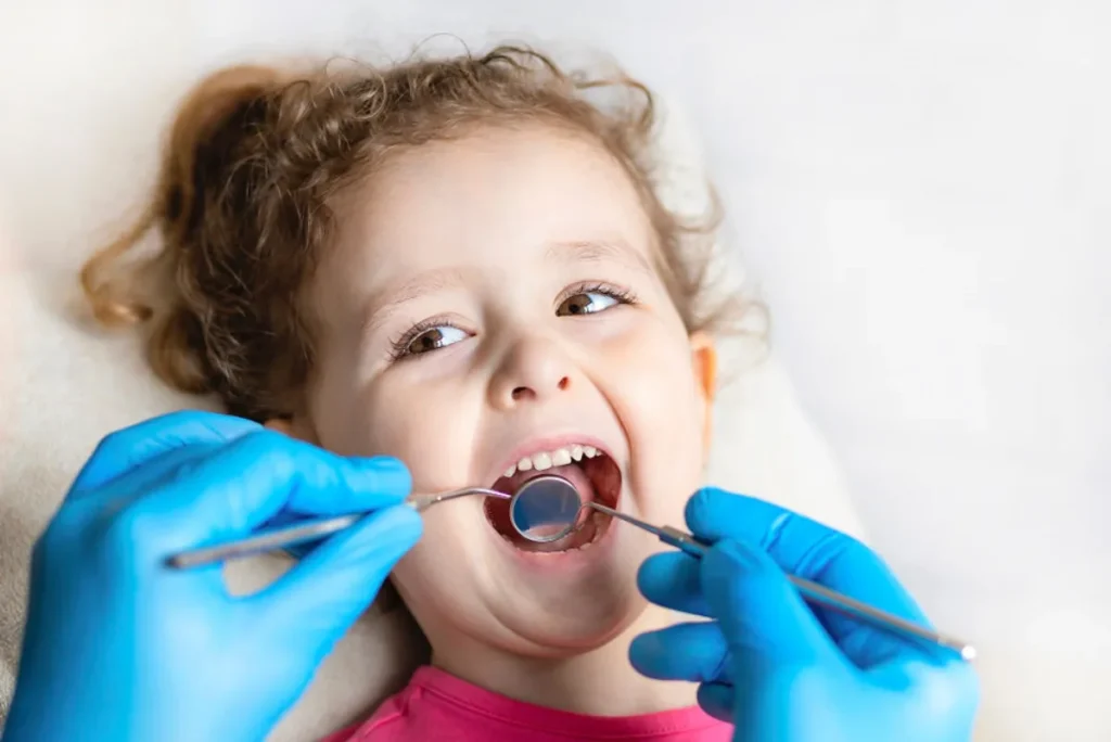 Caries en Niños: Causas y Prevención