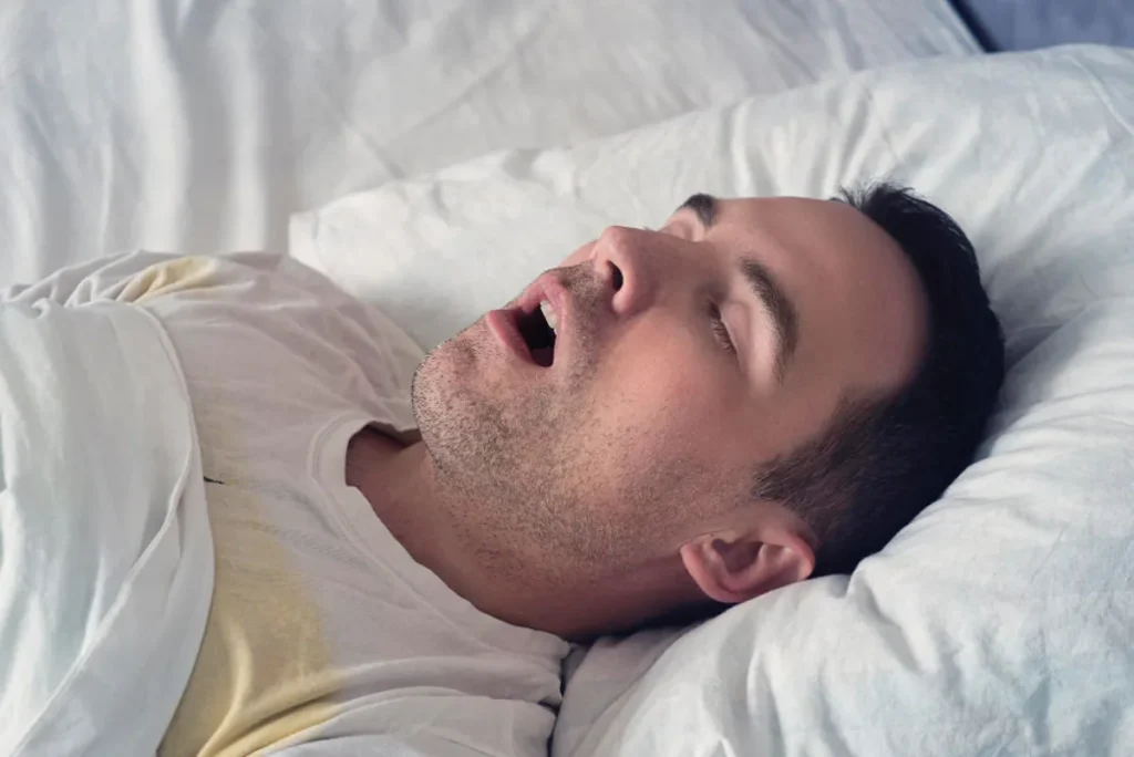 Apnea del Sueño