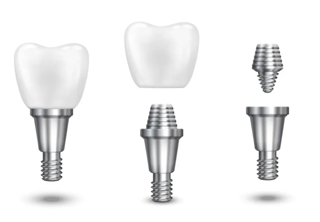Implantólogo Polanco