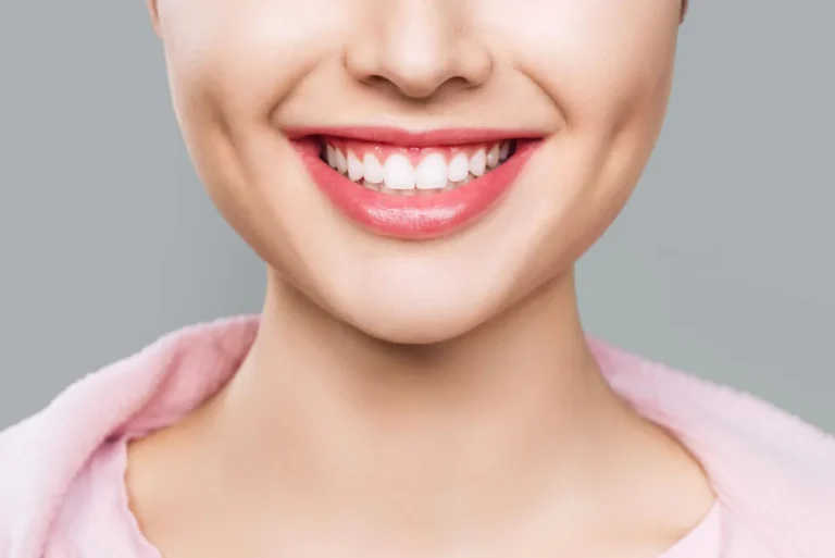 Sonrisa gingival con Invisalign Polanco