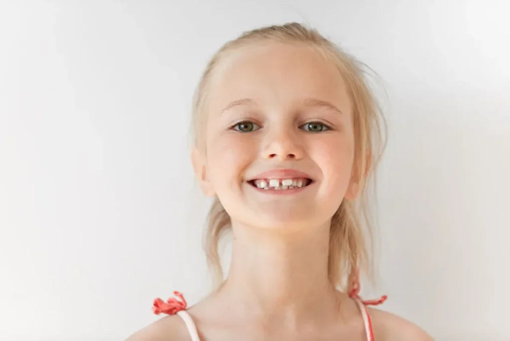 Dientes chuecos en niños