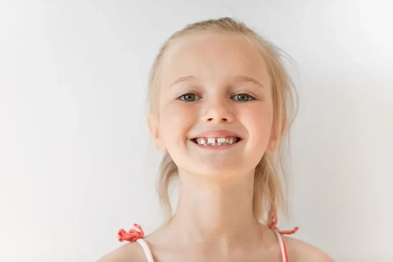 Dientes chuecos en niños