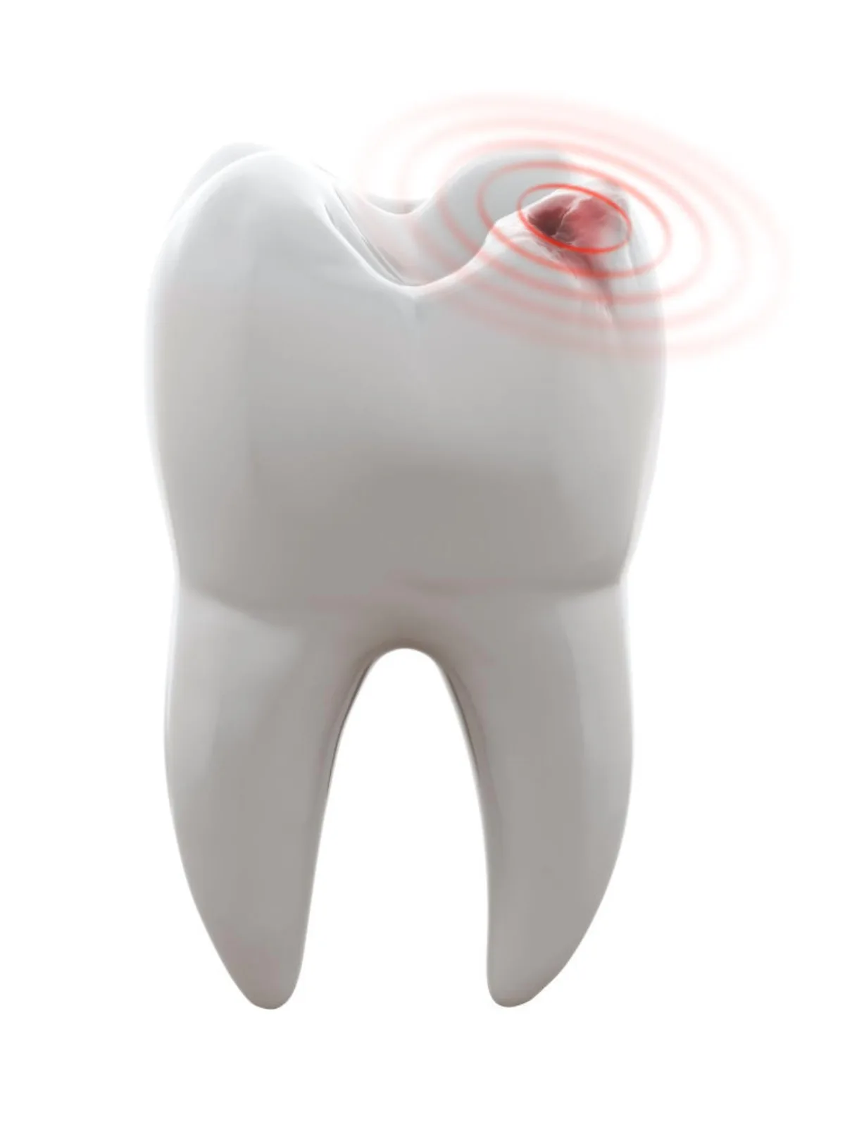 Prevenir Caries