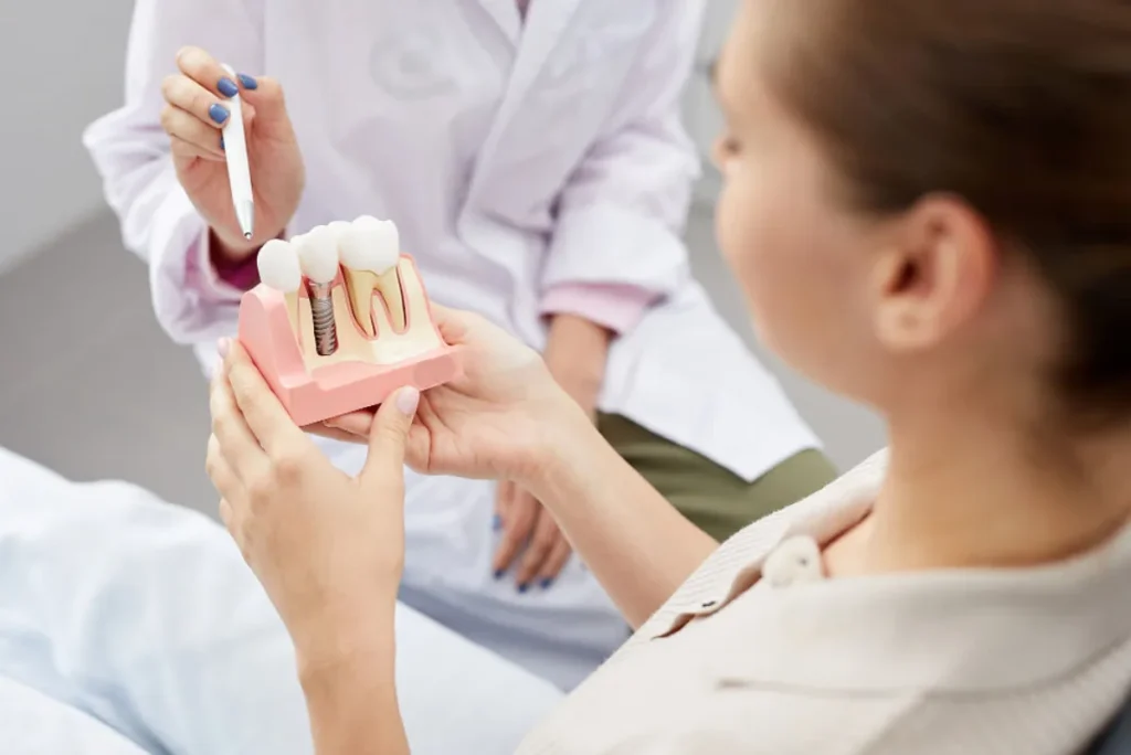 Implante dental Polanco