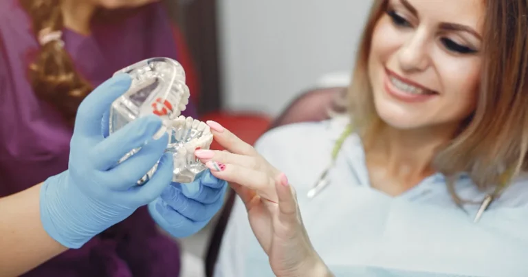 Implantes dentales en Polanco