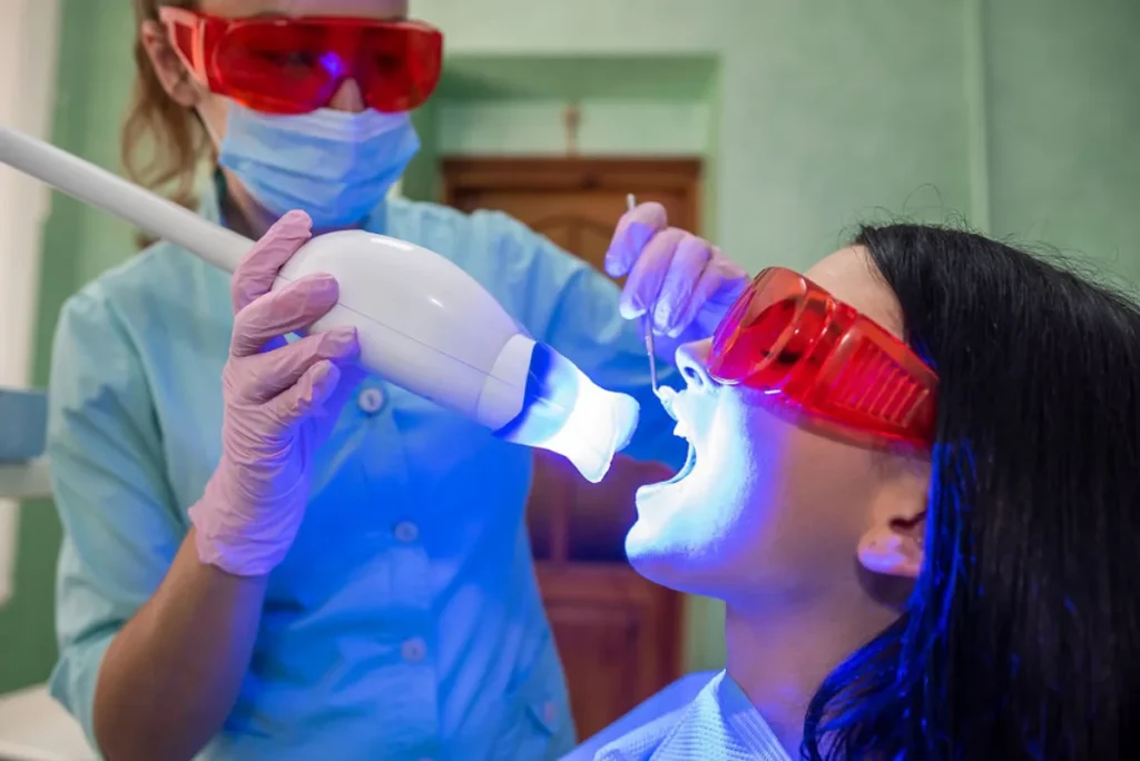 Diferencias entre limpieza dental y blanqueamiento