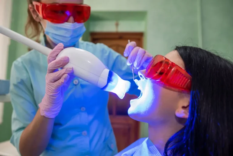 Diferencias entre limpieza dental y blanqueamiento