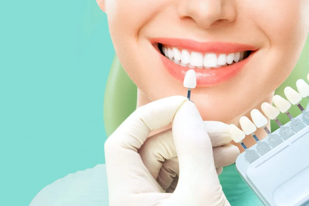 Diseño de Sonrisa Polanco