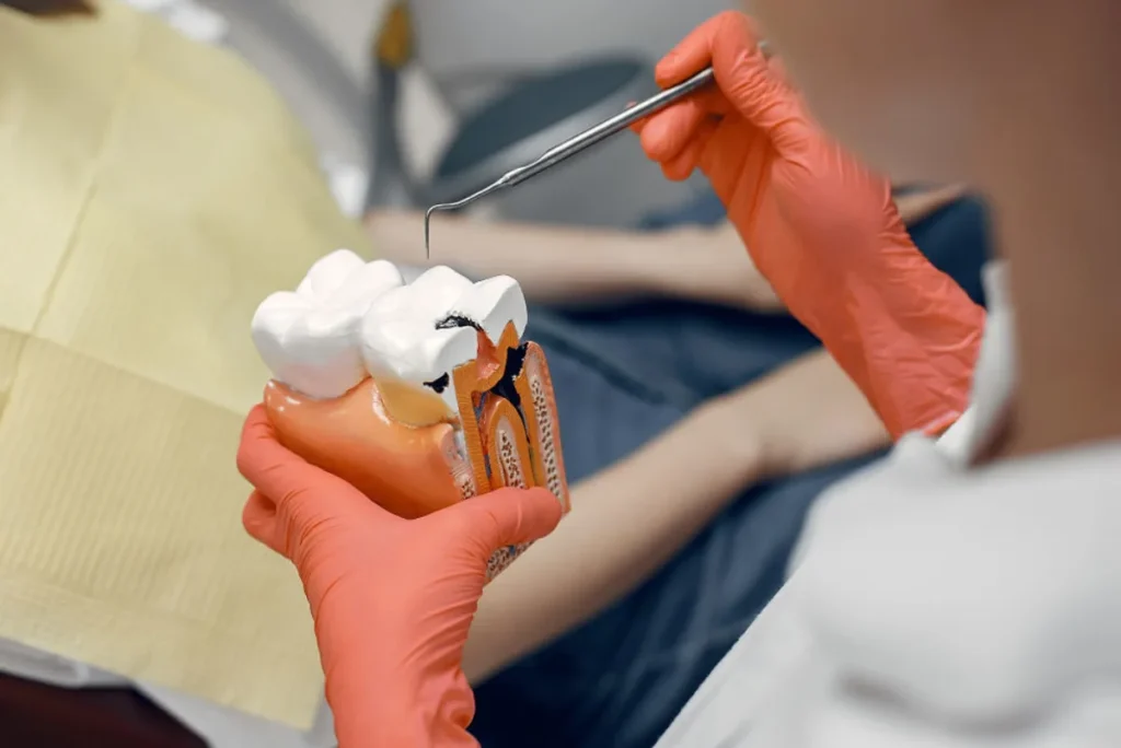 Endodoncista precios