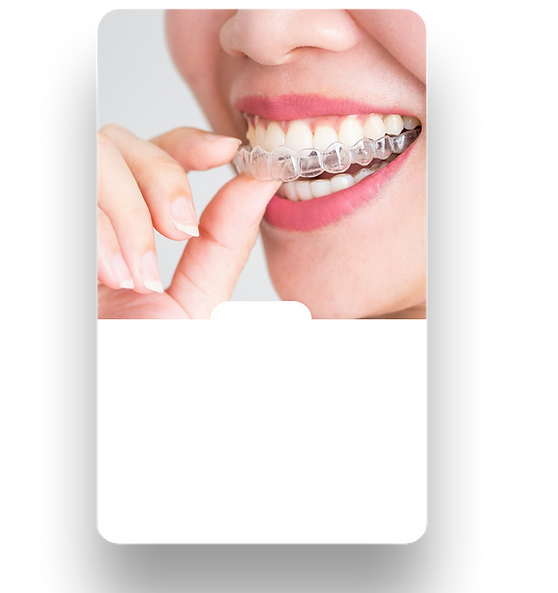 Blanqueamiento dental Polanco