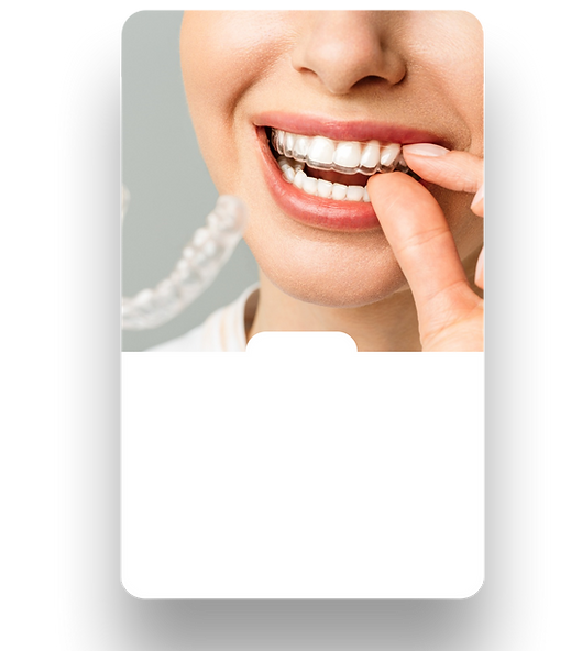SmartTrack Invisalign