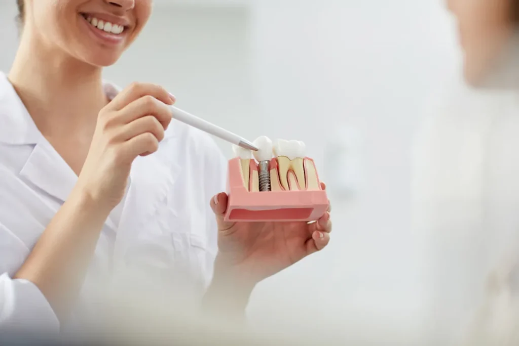 Implantes dentales precios