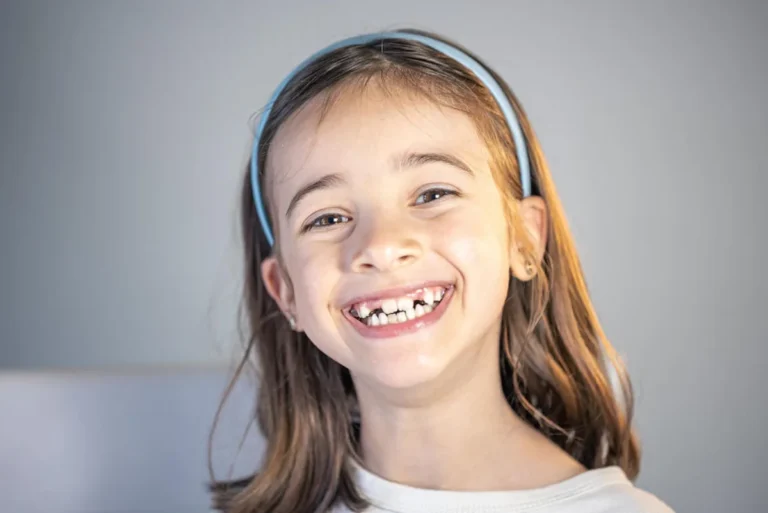 Brackets en niños