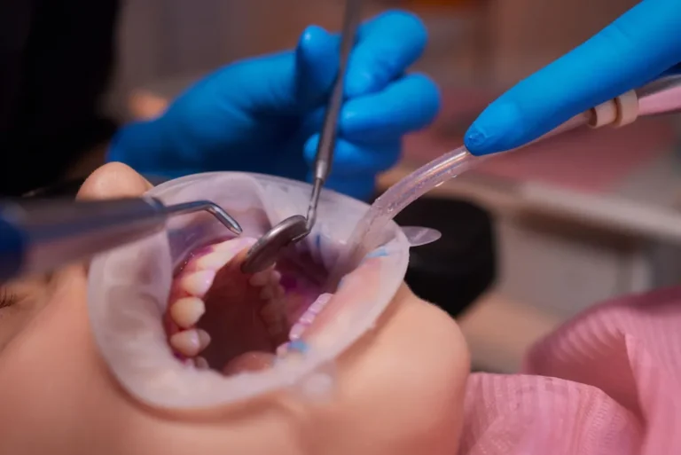 Papel del flúor en la remineralización dental