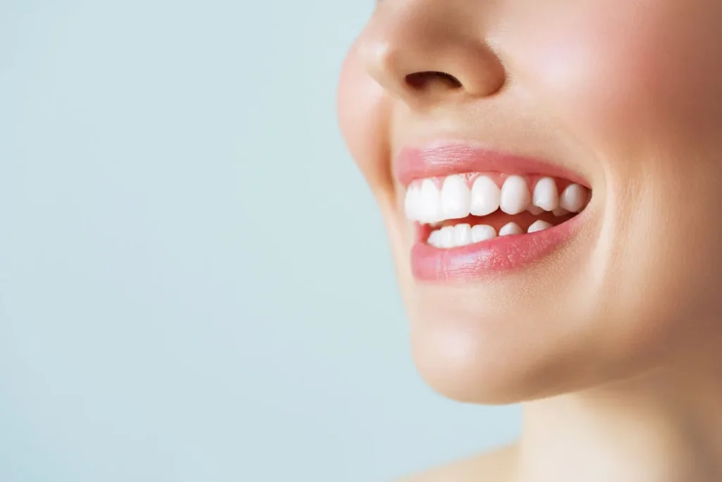 Puedo usar alineadores dentales si tengo carillas