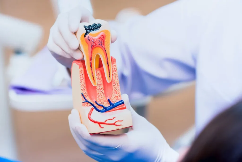 Endodoncia duele