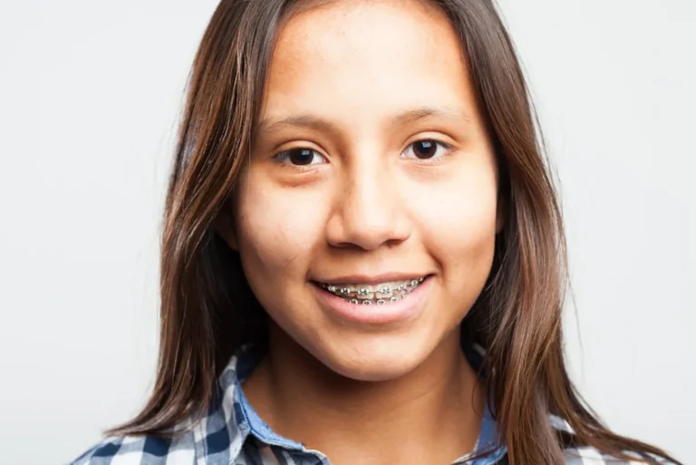 Ortodoncia infantil