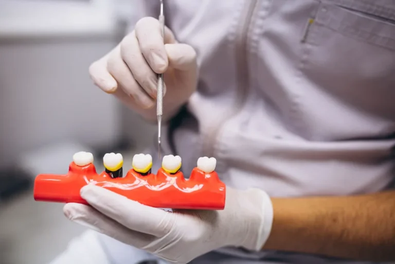 Periodoncista en Polanco